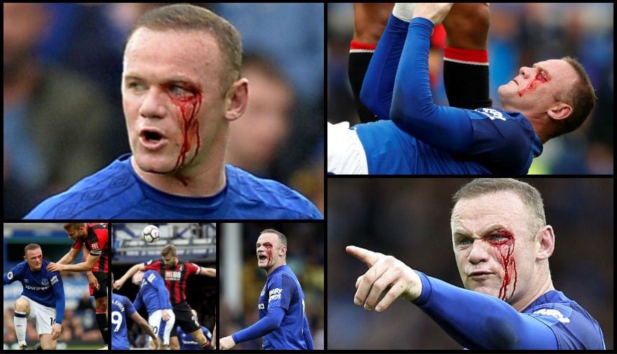 Wayne Rooney acabó sangrando por herida en parpado tras brutal codazo