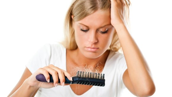 “La alopecia es cualquier tipo de pérdida del cabello, independientemente de su causa", dijo el especialista. (Foto: ThinkStock)