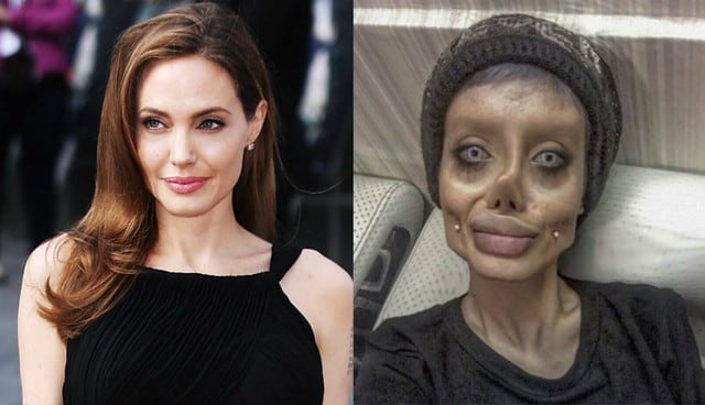Sahar Tabar de 19 años se deformó el rostro por querer parecerse a Angelina Jolie. Foto: Instagram