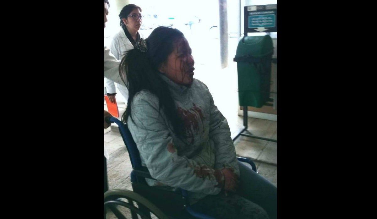 Madre de familia sufrió heridas en el rostro tras ser embestida por el auto. (Fotos: Trome).