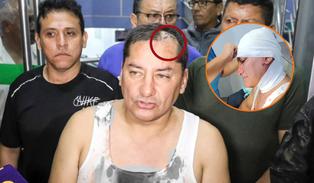 Alcalde de Comas sufre atentado por parte de delincuentes: le rompieron la cabeza y robaron su camioneta