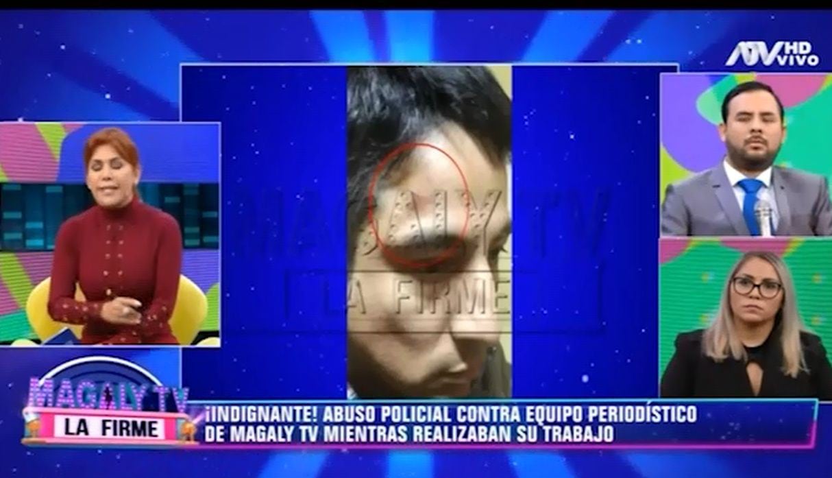 Magaly Medina, indignada por agresión a sus 'Urracos'. (Capturas: Magaly Tv. La firme)