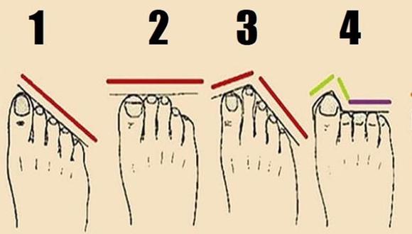 No todos los pies son iguales, por eso tendrás que elegir la forma que se asemeje más a los tuyos. Solo así estarás cerca de la respuesta. (Foto: mdzol)