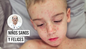 ¿Sabías que el sarampión puede causar complicaciones mortales en niños?