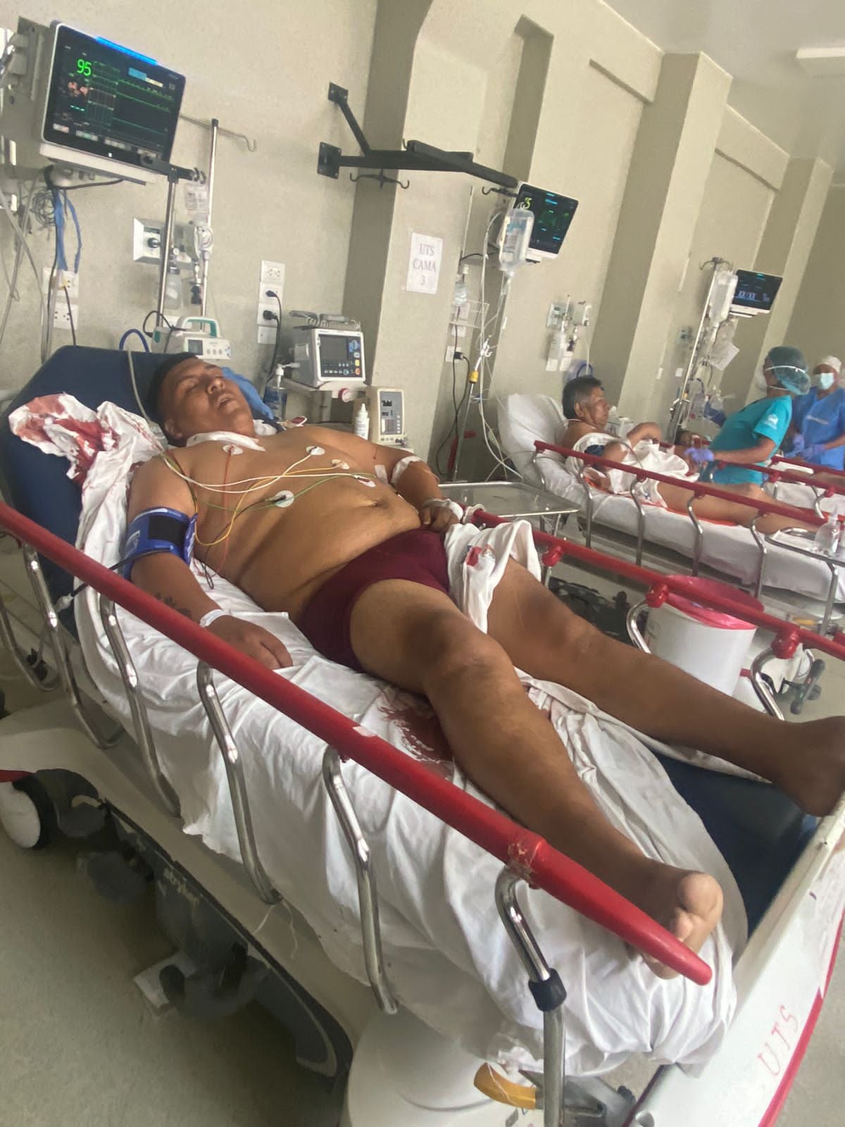 Herido permanece hospitalizado.