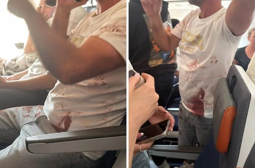 La ropa de un pasajero manchada de sangre. Un avión de Flydubai aterrizó de emergencia en Arabia Saudita tras un incidente entre los pilotos, donde uno de ellos acuchilló al otro. (Captura de video).