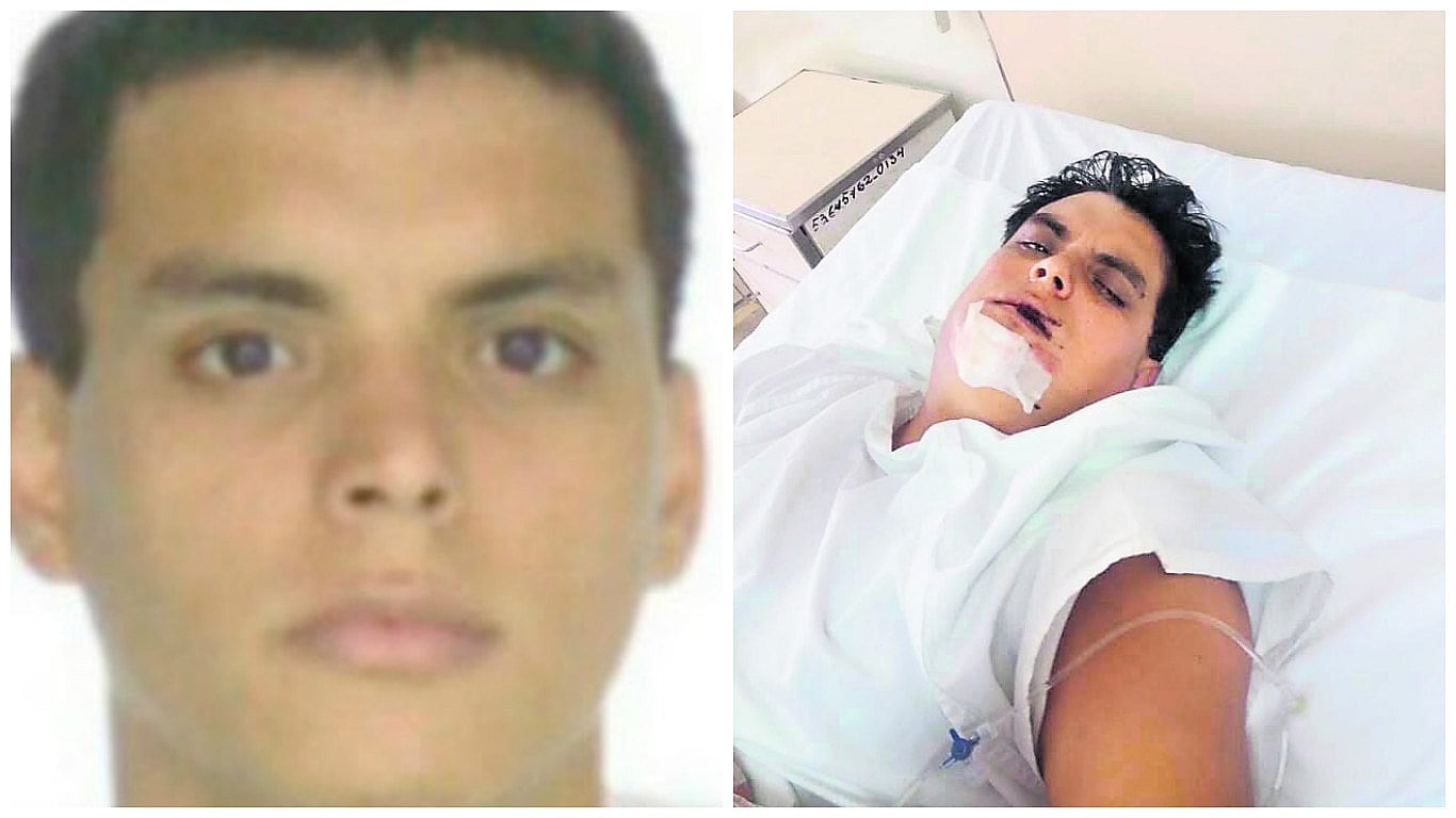 Feroz Careca había sido herido de un balazo en el rostro en el 2020. (VIDEO)