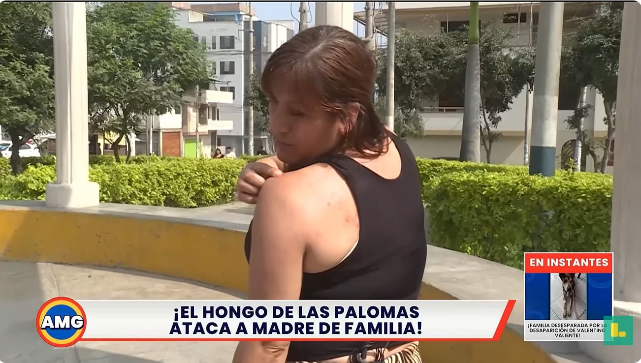 Perdió un dedo por heces de paloma. Foto: Latina