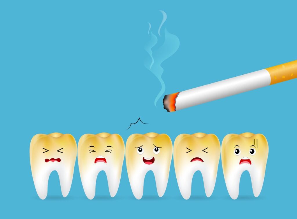 El hueso y los tejidos que sostienen los dientes se pueden descomponer, y es posible que las piezas se suelten y se tengan que sacar. Foto: iStock.