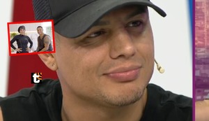 Dra. Fit desmiente a Maicelo tras decir que no se retocó la cara: “Le puse 15 jeringas de ácido hialurónico”