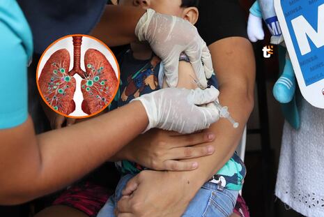 Alerta en Perú por tos ferina: Confirman 408 casos y 10 niños fallecidos, según el Minsa