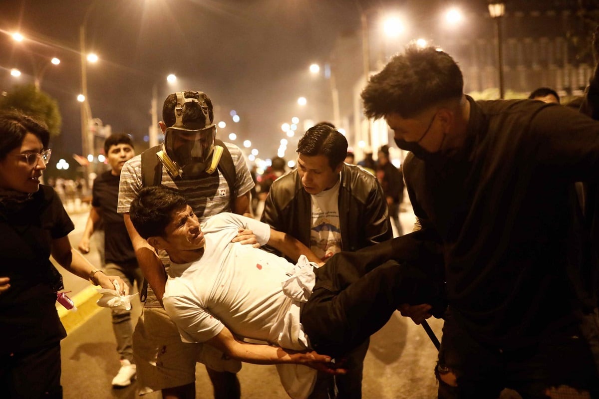 Un manifestante herido en enfrentamientos con la Policía recibe ayuda en el centro de Lima, Perú, el 12 de diciembre de 2022. (Foto de Aldair Mejía / EFE)