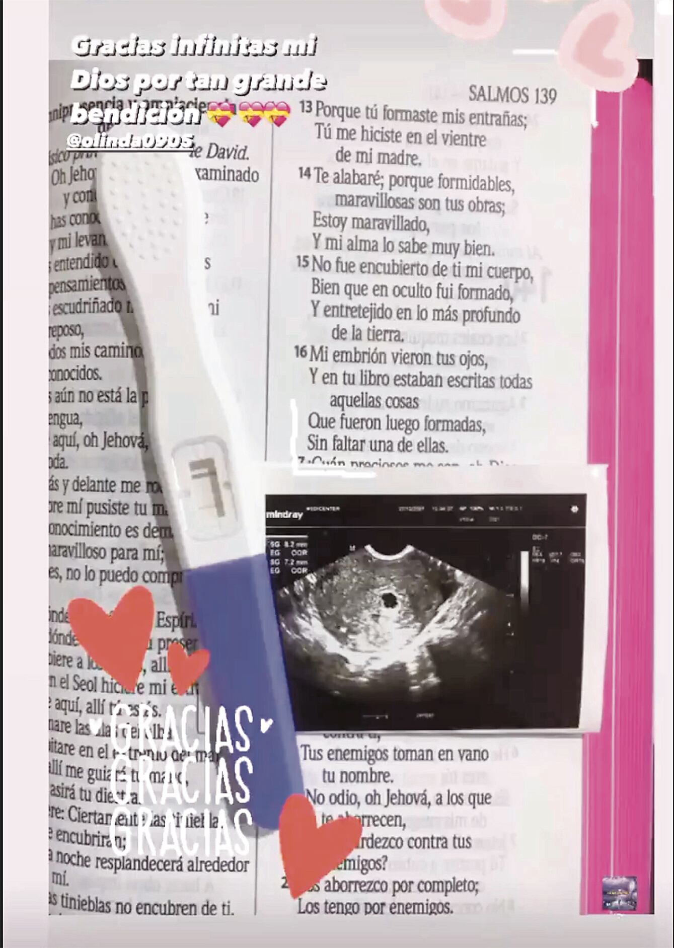 Olinda Castañeda anuncia su embarazado de su esposo Christian Marcial: “Bebé a bordo”