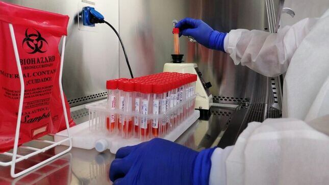 Dependencia también logró identificar cuatro variantes del virus SARS-CoV-2, y realizó trabajos de investigación. Foto: Diresa Cajamarca