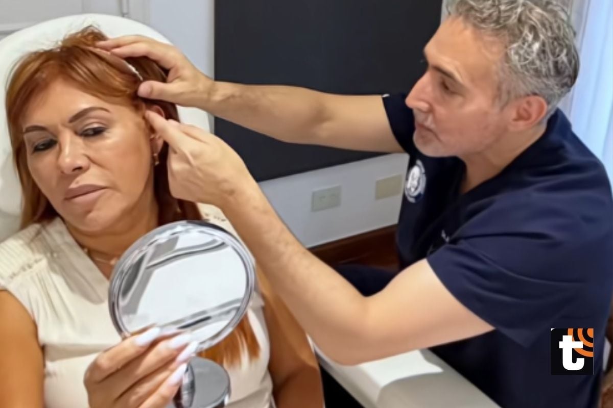 Cirugía facial de Magaly Medina.