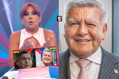 Magaly queda en shock con el nuevo rostro de César Acuña y critica sus ‘retoquitos’: “Le hicieron una mon...