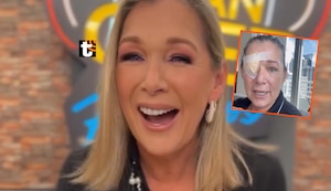 Mónica Zevallos reapareció con un parche en el ojo derecho y contó que tuvieron que operarla