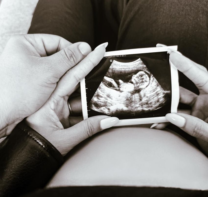 Ricardo Mendoza y su novia comparten ecografía de su bebé tras confirmar embarazo. (Foto: Instagram)