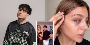 “He podido conversar con ella”: Diealis se pronuncia tras denuncia por agresión a su expareja