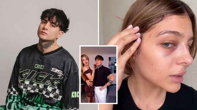 “He podido conversar con ella”: Diealis se pronuncia tras denuncia por agresión a su expareja