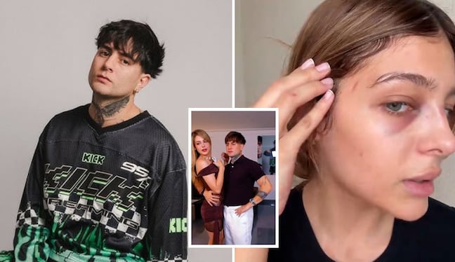 “He podido conversar con ella”: Diealis se pronuncia tras denuncia por agresión a su expareja