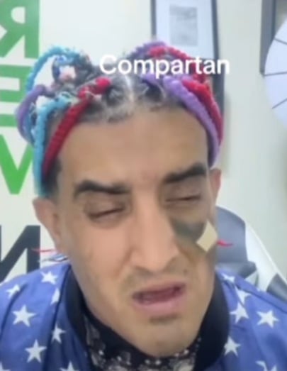 Makanaky llora por puñete de Chachi. (Redes sociales)