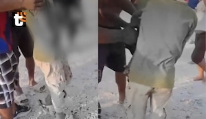 ¡Tragedia en Piura! Niño pierde la mano tras manipular pirotécnico que encontró en la calle