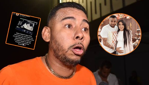 Abel Lobatón sobre el supuesto embarazo de Samahara