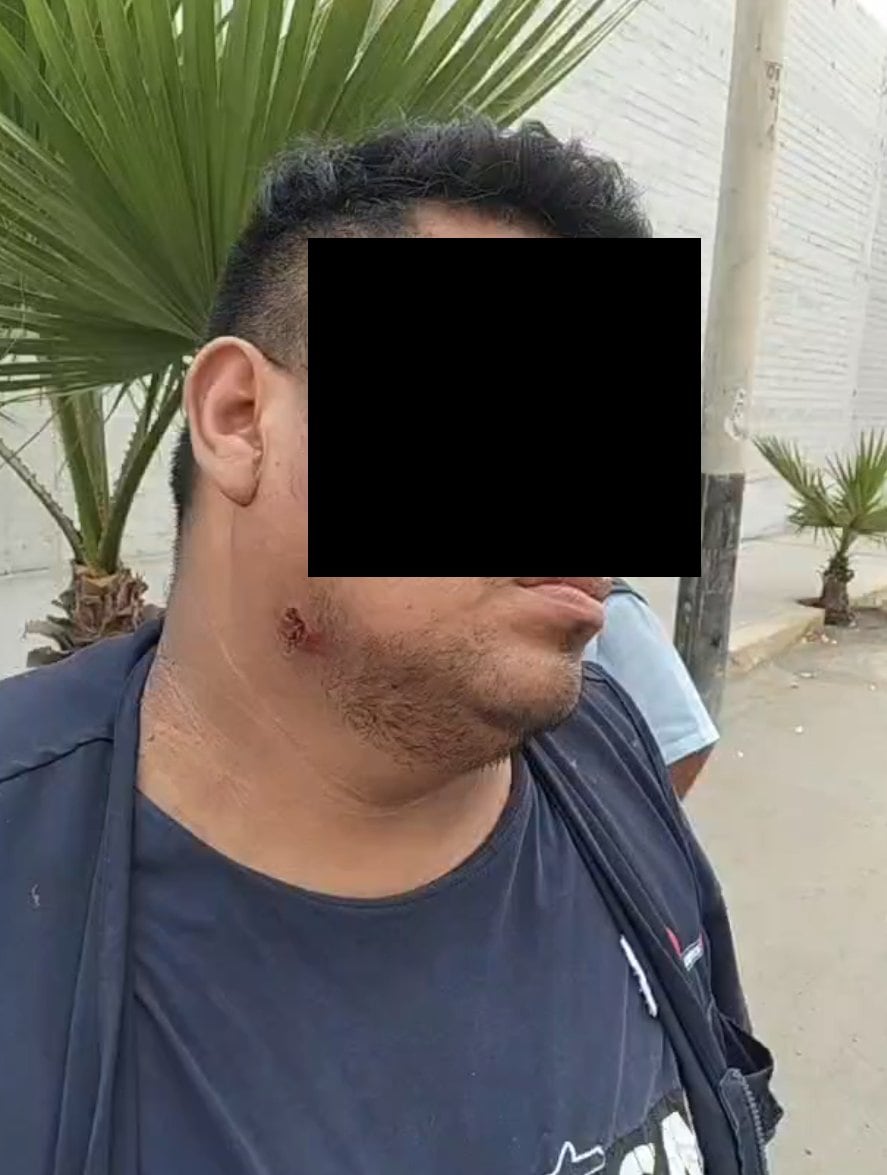 Chofer resultó con una leve herida tras el atentado. (Foto: Difusión)