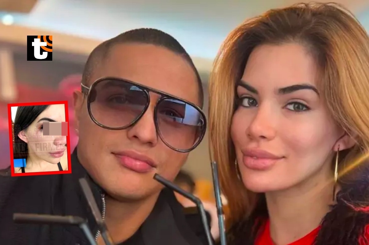 Samantha Batallanos narra infierno que vivió con Jonathan Maicelo