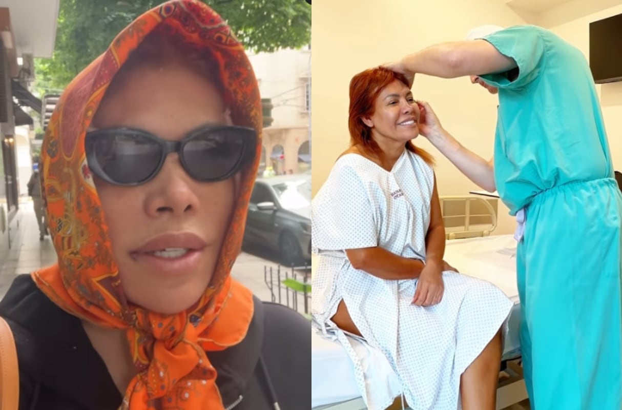 Magaly Medina muestra su rostro tras someterse a cirugía estética en Argentina. (Foto: Captura de video)