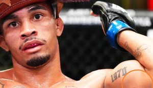 A lo Mike Tyson: Peleador muerde a su rival en una pelea del UFC | VIDEO