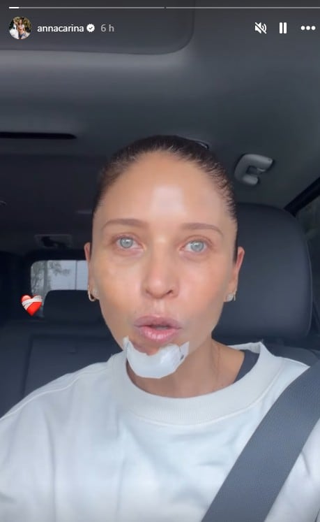 Anna Carina Copello relata cómo ocurrió el accidente.