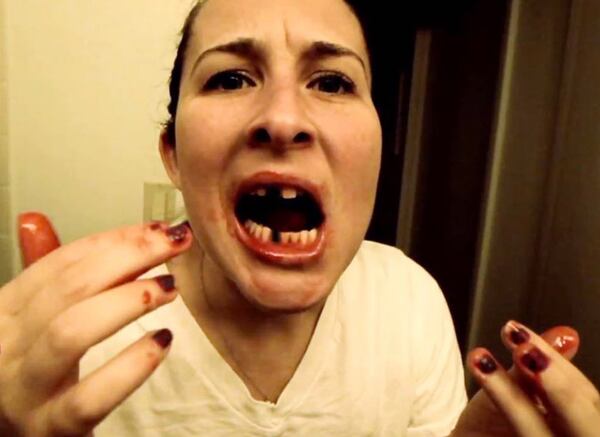 Conoce qué significa soñar con caída de dientes.