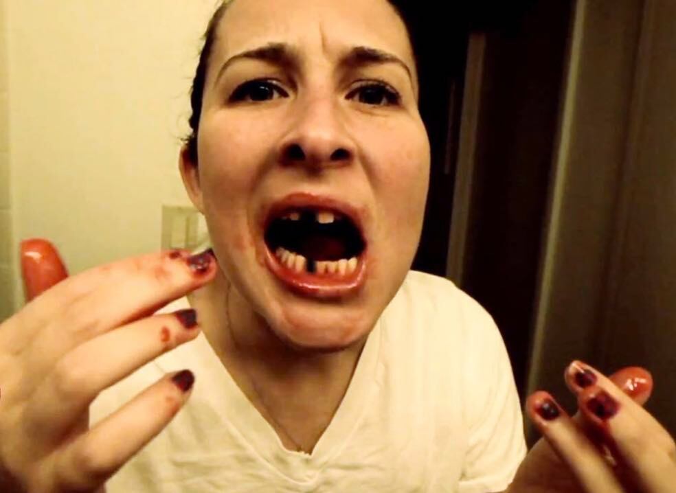 Conoce qué significa soñar con caída de dientes.