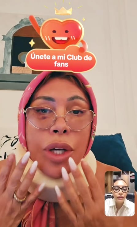 Conductora reaparece tras delicada cirugía en el rostro. (Fuente: TikTok)