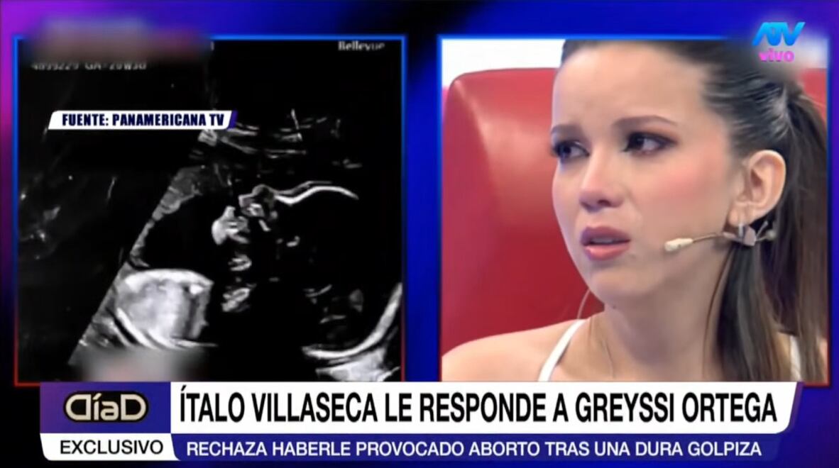 Ítalo Villaseca afirma que su bebé no murió porque golpeó a Greissy Ortega.