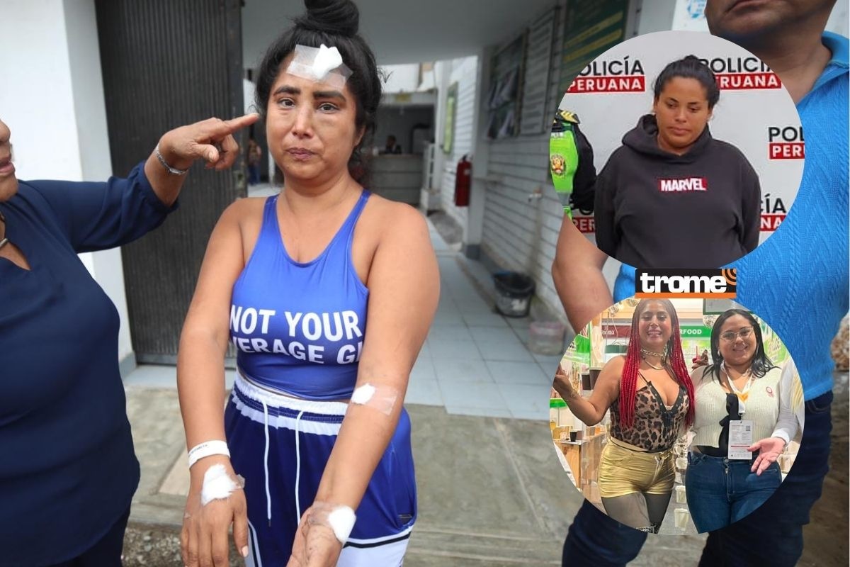 La emprendedora muestra las lesiones causadas en la cabeza y brazos producto del asalto. | Foto: Diana Marcelo / Diario Trome / Composición Trome