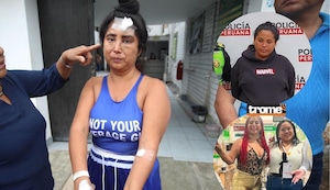 Secretaria embarazada habría dirigido robo a su jefa: “Me rompieron la cabeza, me fracturaron la nariz, me dieron cachetadas”