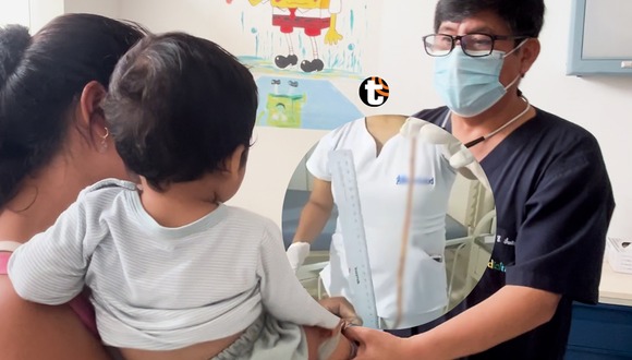 Médicos de EsSalud Huánuco atienden a bebé de dos años que expulsó lombriz intestinal de más de 40 centímetros. Foto y video: EsSalud.
