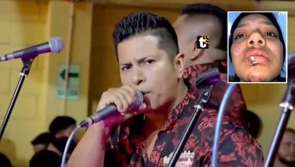Joven hace valiente denuncia contra vocalista principal de Los Rebeldes de la Cumbia. (Captura Magaly Tv)