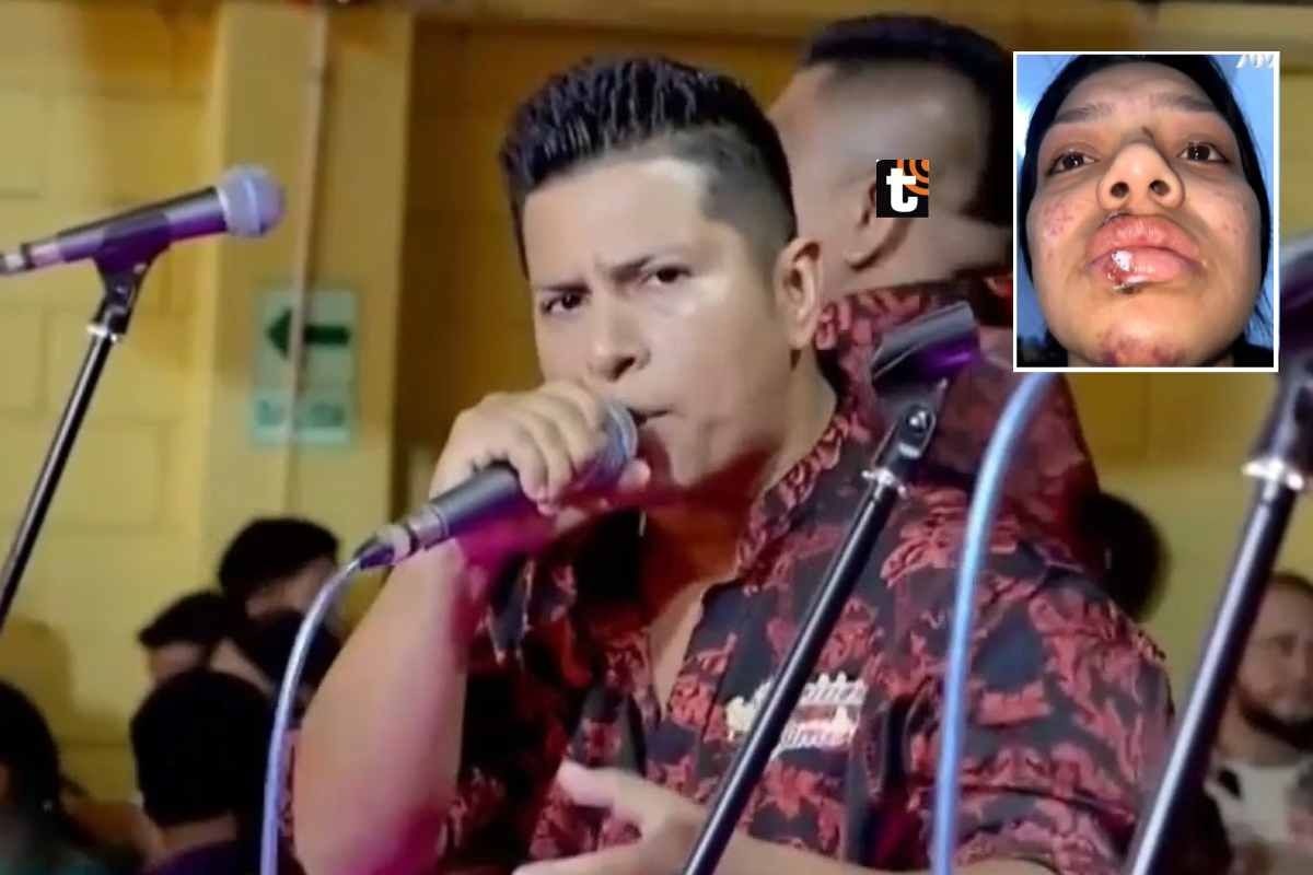 Joven hace valiente denuncia contra vocalista principal de Los Rebeldes de la Cumbia. (Captura Magaly Tv)