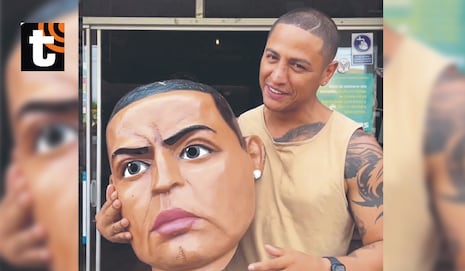 Jonathan Maicelo niega otros ‘retoquitos’ en el rostro: “Solo me operé la nariz, mis labios son naturales...