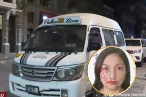 Callao: Delincuentes balean combi llena de pasajeros y matan a mujer de 45 años