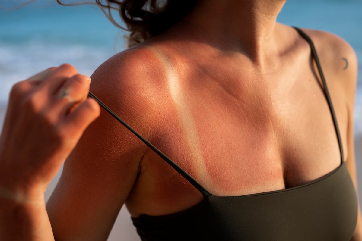 "Ya sea en una cama de bronceado o al sol, ese brillo 'saludable' que estás obteniendo es en realidad evidencia de que la radiación ultravioleta está dañando tu piel"