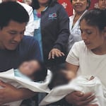 Separan a siamesas unidas por la columna