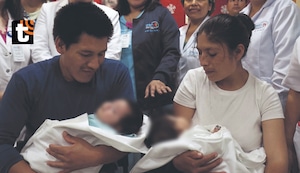 ¡Milagro navideño! Separan a siamesas unidas por la columna: bebés estuvieron en UCI, pero ya están a salvo