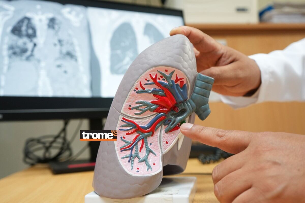 Gracias a donante, médicos especialistas y equipo adecuado se realizó exitoso trasplante de ambos pulmones en adulto mayor. (EsSalud)