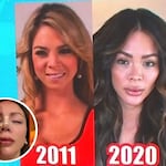 ¡Se operó! La nueva nariz de Sheyla Rojas causa impacto