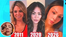 Sheyla Rojas se opera una vez más: mira el resultado de su nueva nariz
